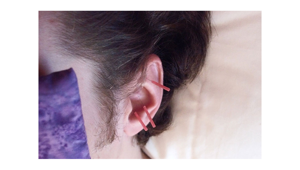 L'oreille bien entendu, petit traité sur l’auriculothérapie 